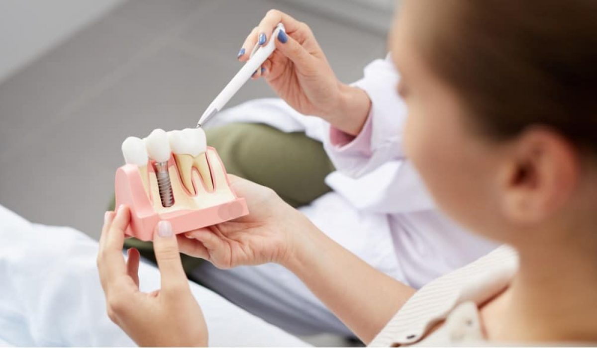 The Transformative Power of Dental Implants